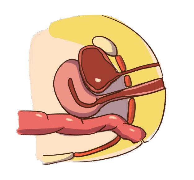 强健敏感的盆底肌肉可以维持阴道壁张力和性高潮感觉,松弛虚弱的