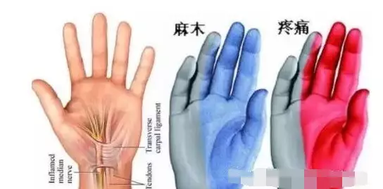 手凉,手抖,手麻…这都是病!