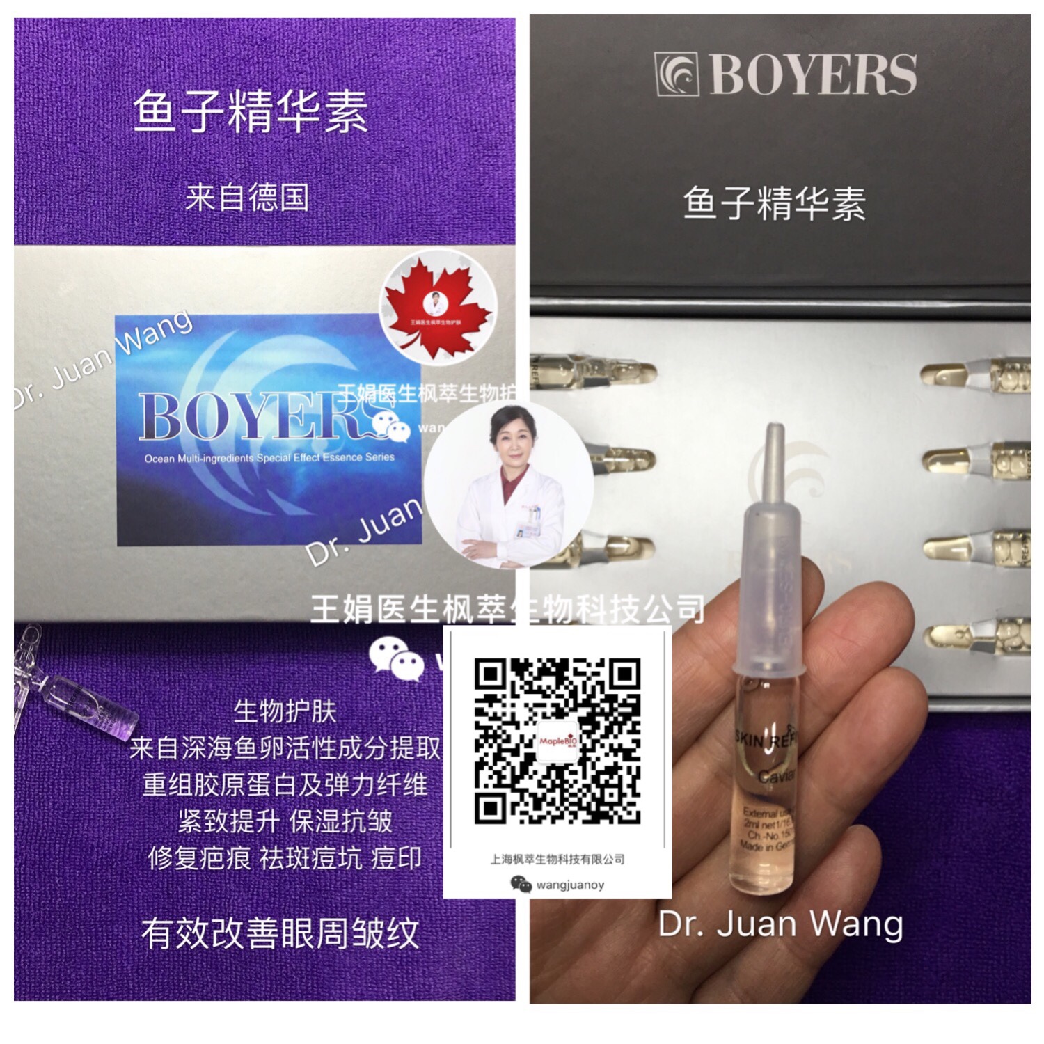 囊肿型痤疮～最严重的类型