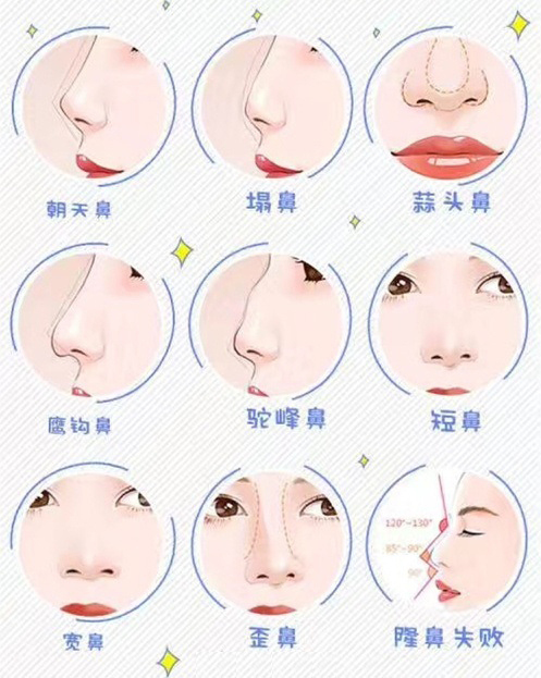 贵阳隆鼻医院|想做隆鼻手术,该怎么做出选择呢?